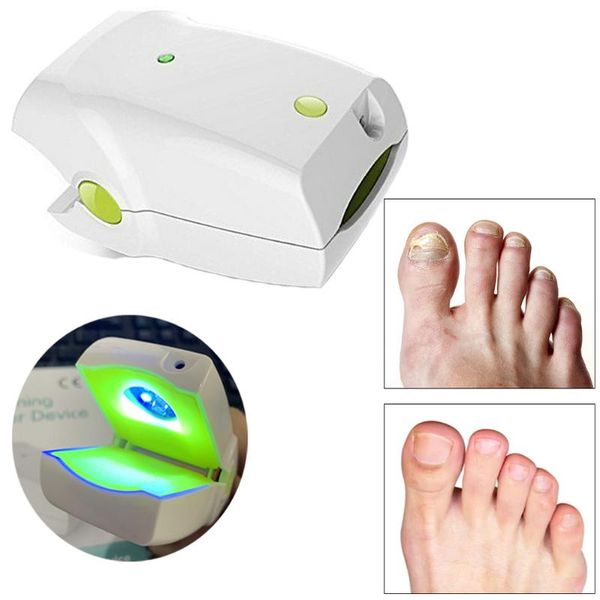 nail cleaning laser device painless nail fungus laser treatment infection cure fungal infections
nail cleaning laser device painless nail fungus laser treatment infection cure fungal infections