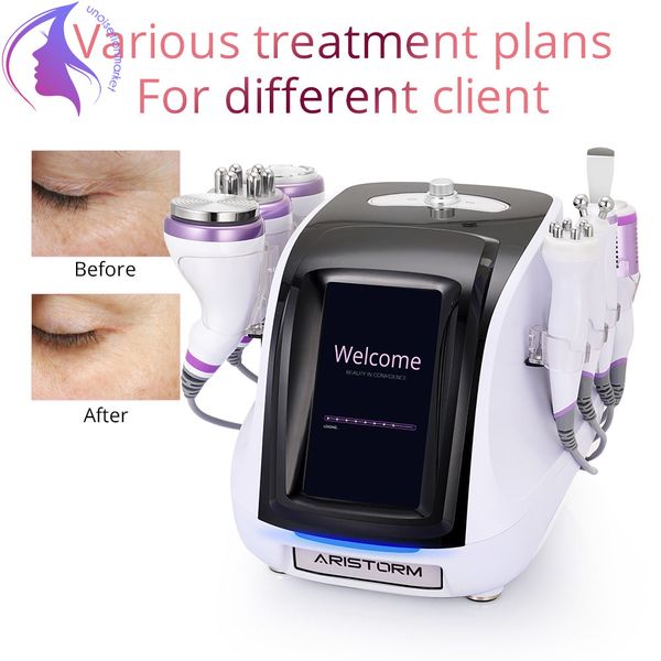 multifunction bi-polar radio frequency vacuum slimming beauty device weight loss bodyshape machine suitable for multiple parts of the body
multifunction bi-polar radio frequency vacuum slimming beauty device weight loss bodyshape machine suitable for multiple parts of the body
