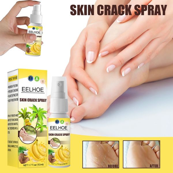 skin crack spray banana coconut cream foot anti-drying winter moisturizing feet care removal dead-skin 1383
skin crack spray banana coconut cream foot anti-drying winter moisturizing feet care removal dead-skin 1383