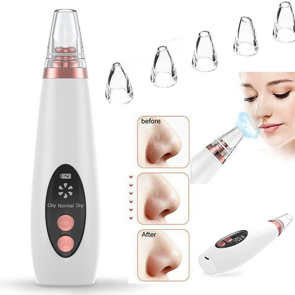 blackhead remover pore cleaner vacuum moisture facial skin care suction blackheads black spots blackheads removal deep cleansing
blackhead remover pore cleaner vacuum moisture facial skin care suction blackheads black spots blackheads removal deep cleansing