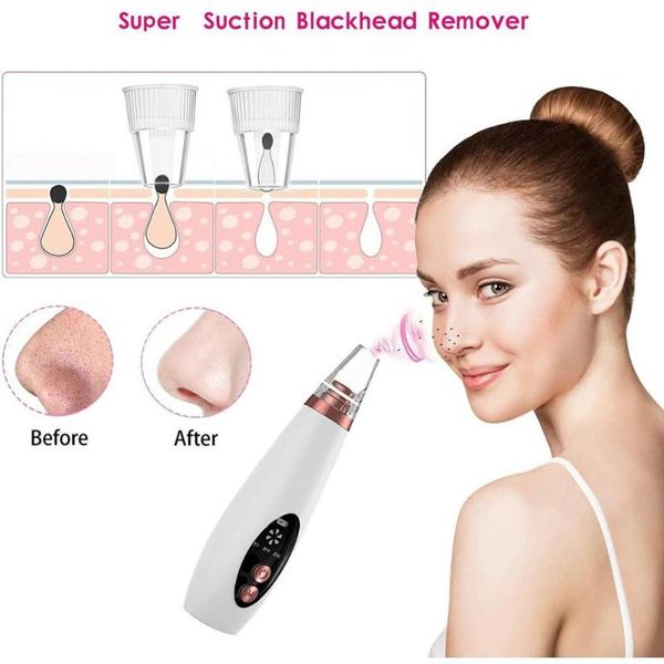 cleaning blackhead remover usb rechargeable face deep cleaner t zone pore acne pimple removal vacuum suction beauty clean skin tool
cleaning blackhead remover usb rechargeable face deep cleaner t zone pore acne pimple removal vacuum suction beauty clean skin tool