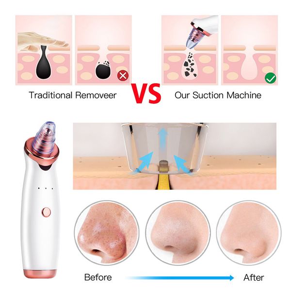 microdermabrasion blackhead remover vacuum suction face pimple acne comedone extractor facial pores cleaner skin care tools 38
microdermabrasion blackhead remover vacuum suction face pimple acne comedone extractor facial pores cleaner skin care tools 38