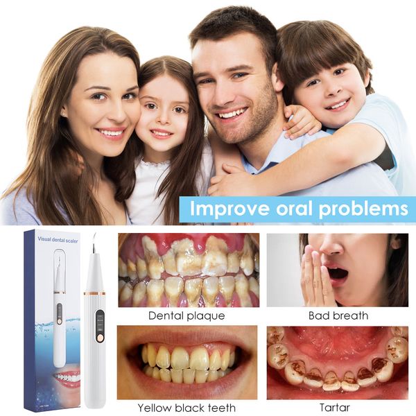 ultrasonicteethcleanerdentaltartarstoneremoverhdvisualscalerelectricoralirrigatorslimpiezadentalteethwhitening raben
ultrasonicteethcleanerdentaltartarstoneremoverhdvisualscalerelectricoralirrigatorslimpiezadentalteethwhitening raben
