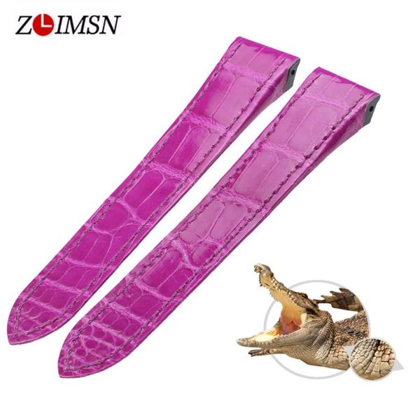 watch bands zlimsn luxury crocodile leather strap red comfortable waterproof fine craft tailoring 12mm-26mm for men's women's, Black;brown
watch bands zlimsn luxury crocodile leather strap red comfortable waterproof fine craft tailoring 12mm-26mm for men's women's, Black;brown