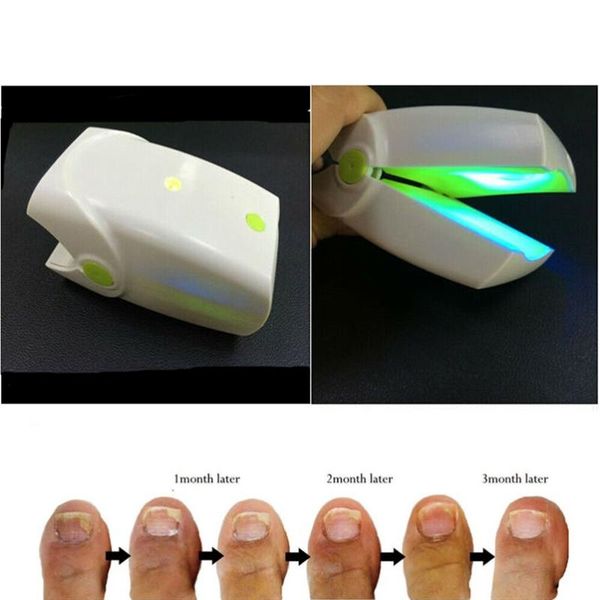 nail cleaning laser device, anti foot nails fungal treatment infection electric massagers
nail cleaning laser device, anti foot nails fungal treatment infection electric massagers