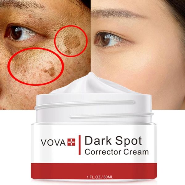 massage stones & rocks face cream dark spots removal whiten and brighten skin tone spot corrector
massage stones & rocks face cream dark spots removal whiten and brighten skin tone spot corrector