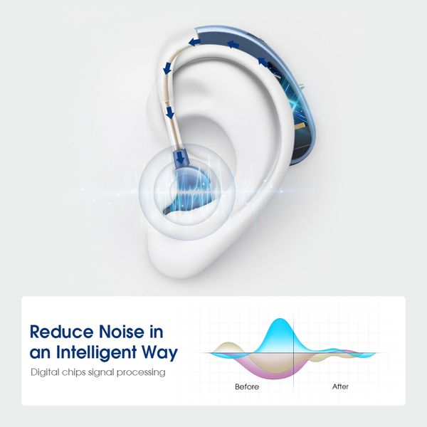 wireless mini rechargeable hearing aidintelligent digital noise reduction sound amplifiersuitable for moderate hearing lossscouts
wireless mini rechargeable hearing aidintelligent digital noise reduction sound amplifiersuitable for moderate hearing lossscouts