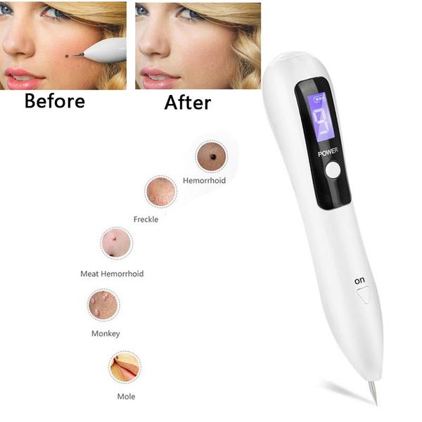 cleaning led lighting plasma pen remove freckles tattoo facial treatment mole spots clean beauty
cleaning led lighting plasma pen remove freckles tattoo facial treatment mole spots clean beauty