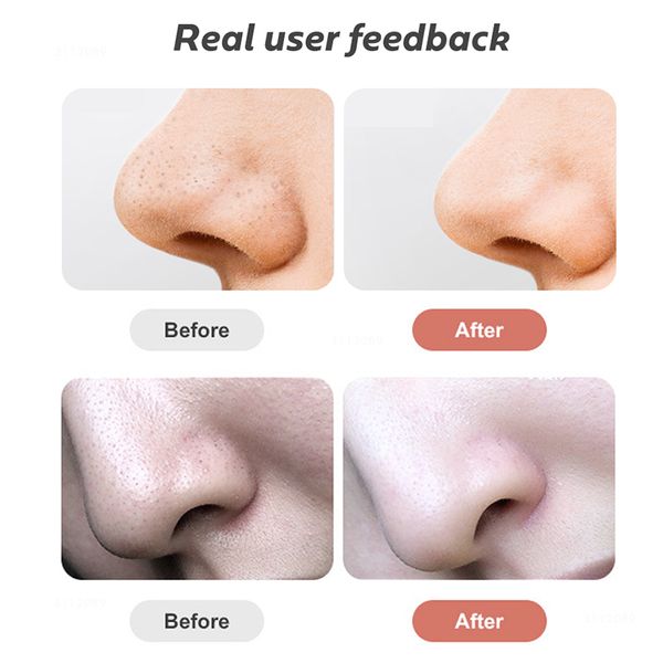 blackhead remover vacuum electric nose beauty face deep cleansing skin care vacuum black spots acne pore cleaner pimple tool
blackhead remover vacuum electric nose beauty face deep cleansing skin care vacuum black spots acne pore cleaner pimple tool