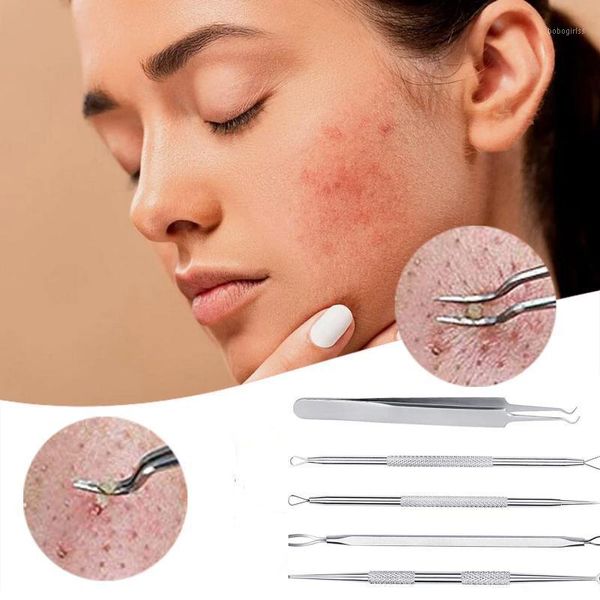 5pcs professional dual heads acne needle blackhead blemish pimple extractor remover spot cleaner beauty face skin care tool 309 eyebrow tool
5pcs professional dual heads acne needle blackhead blemish pimple extractor remover spot cleaner beauty face skin care tool 309 eyebrow tool