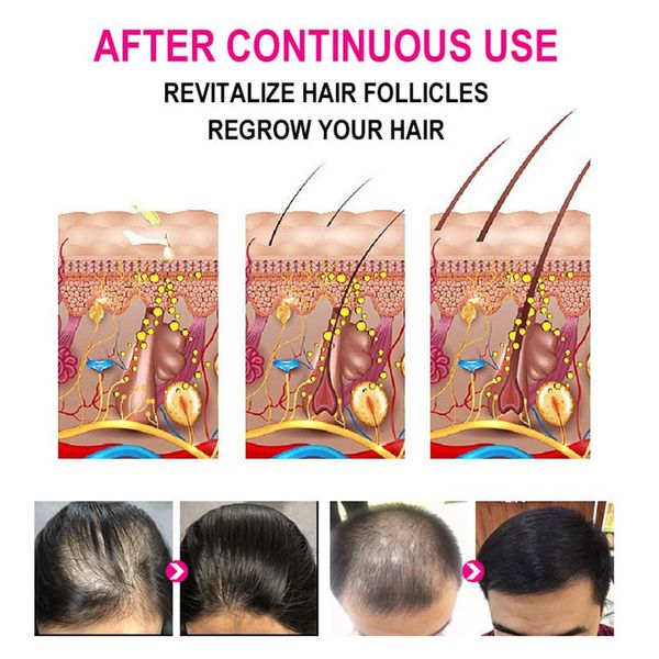sevich natural hair growth kit anti hair loss 200ml ginger hair shampoo 30ml dye blackening growth spray for treatment
sevich natural hair growth kit anti hair loss 200ml ginger hair shampoo 30ml dye blackening growth spray for treatment