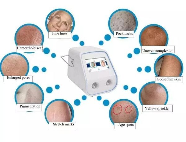 2021 rf fractional acne treating machine /non ablative age spot removal/no damage skin resurfacing anti aging wrinle removal
2021 rf fractional acne treating machine /non ablative age spot removal/no damage skin resurfacing anti aging wrinle removal