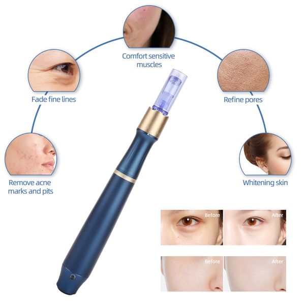 professionaldermamicroneedlesystemwirelessdermapenh3with12pindermastampskincaretoolsdrpenmesobeautymachine raben
professionaldermamicroneedlesystemwirelessdermapenh3with12pindermastampskincaretoolsdrpenmesobeautymachine raben