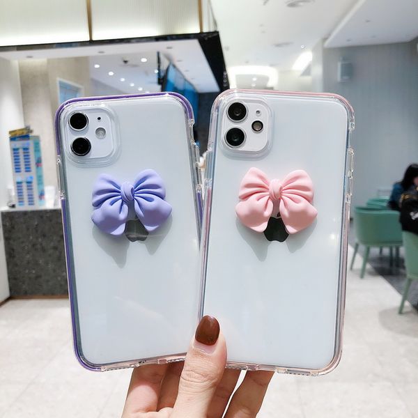 bow pattern transparent tpu phone cases for iphone 12 11 pro promax x xs xsmax 7 8 plus
bow pattern transparent tpu phone cases for iphone 12 11 pro promax x xs xsmax 7 8 plus