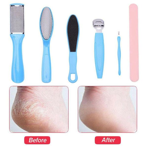 nail art kits 8pcs gentle foot dead hard skin remover scraper pedicure portable tool
nail art kits 8pcs gentle foot dead hard skin remover scraper pedicure portable tool