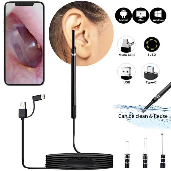 3 in 1 earpick endoscope multifunctional usb ear cleaning tool hd visual earcare spoon clean2m medical otoscope digital for android phone pc
3 in 1 earpick endoscope multifunctional usb ear cleaning tool hd visual earcare spoon clean2m medical otoscope digital for android phone pc