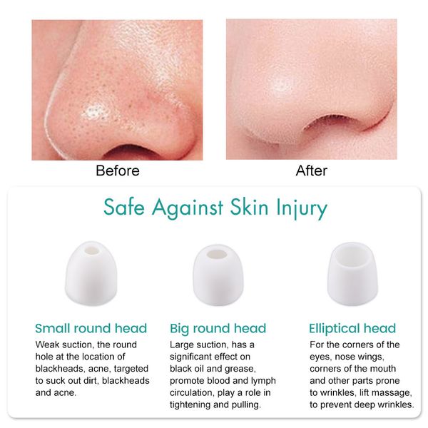 wificameravisualfacialblackheadremoverelectricacnecleanerblackpointvacuumcleanerblackspotsporecleanermachine raben
wificameravisualfacialblackheadremoverelectricacnecleanerblackpointvacuumcleanerblackspotsporecleanermachine raben