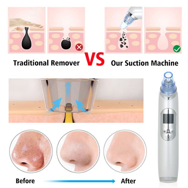 blackhead remover pore vacuum electric blackhead vacuum cleaner blackhead extractor tool device with 5pcs acne removing toolsscouts
blackhead remover pore vacuum electric blackhead vacuum cleaner blackhead extractor tool device with 5pcs acne removing toolsscouts