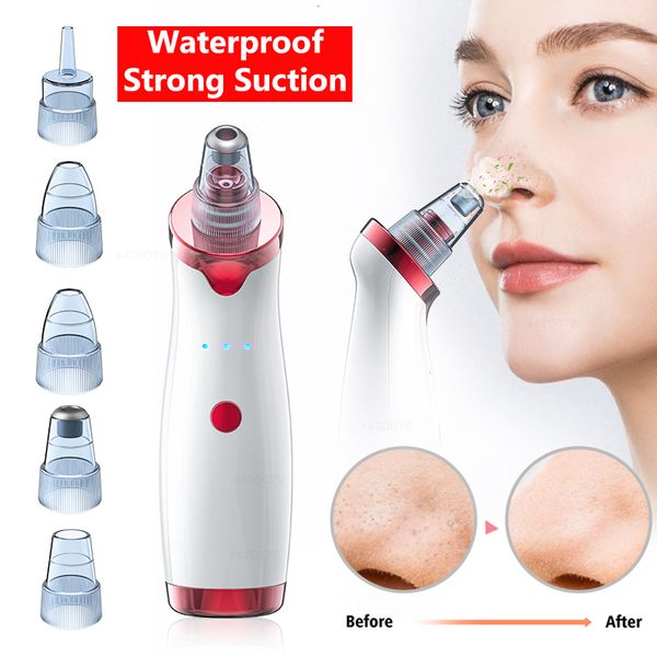 blackhead remover point noir acne vacuum extractor tool black head remover pore cleaner skin care facial pore cleaner machine
blackhead remover point noir acne vacuum extractor tool black head remover pore cleaner skin care facial pore cleaner machine