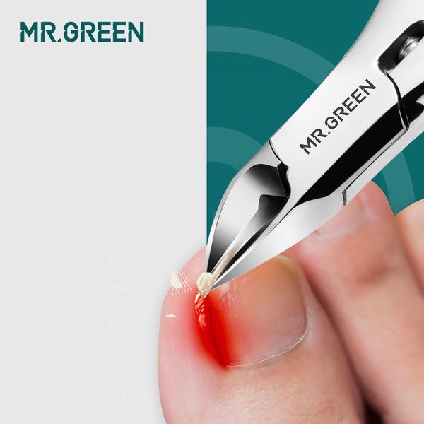 mr.green ditch special eagle mouth clippers large pedicure thick gray toe nail scissors 210324
mr.green ditch special eagle mouth clippers large pedicure thick gray toe nail scissors 210324