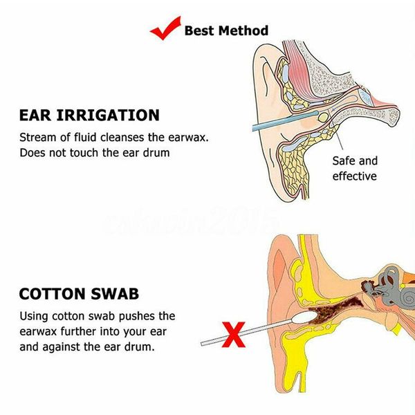 300ml ear cleaning irrigation kit ear wax removal tool water washing syringe squeeze bulb ear cleaner for adults kids earwaxscou
300ml ear cleaning irrigation kit ear wax removal tool water washing syringe squeeze bulb ear cleaner for adults kids earwaxscou