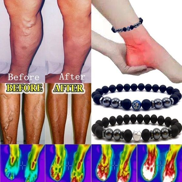 anklets colorful weight loss magnet anklet stone magnetic therapy bracelet product slimming health care jewelry, Red;blue
anklets colorful weight loss magnet anklet stone magnetic therapy bracelet product slimming health care jewelry, Red;blue