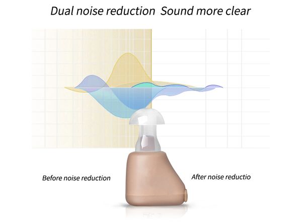 axon k-88 ear aid rechargeable hearing aid bte hearing aids ear listening device adjustable tone hearing amplifier hear aidscouts
axon k-88 ear aid rechargeable hearing aid bte hearing aids ear listening device adjustable tone hearing amplifier hear aidscouts