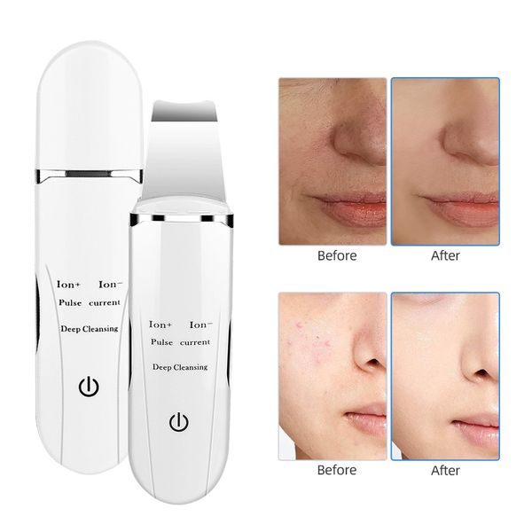 ultrasonic facial deep cleaning skin scrubber peeling shovel face pore cleaner blackhead removal lifting beauty salon equipment
ultrasonic facial deep cleaning skin scrubber peeling shovel face pore cleaner blackhead removal lifting beauty salon equipment