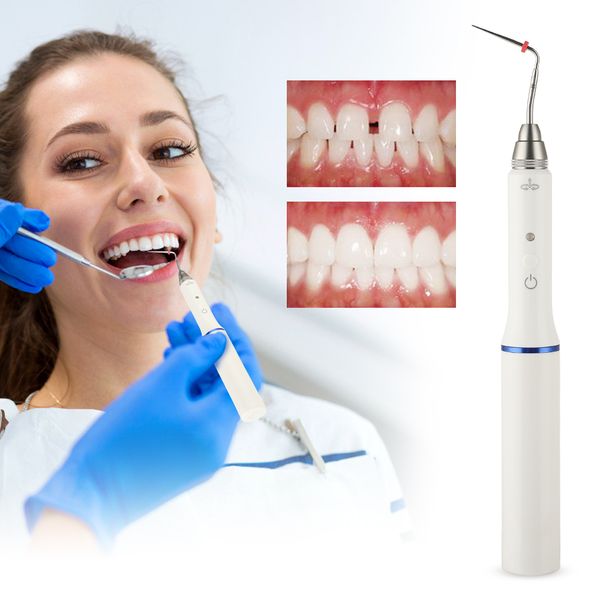 dentalcordlesswirelessendoguttaperchaobturationteethwhiteningoralhygienetoothgumdentalguttaperchawith2tips raben
dentalcordlesswirelessendoguttaperchaobturationteethwhiteningoralhygienetoothgumdentalguttaperchawith2tips raben