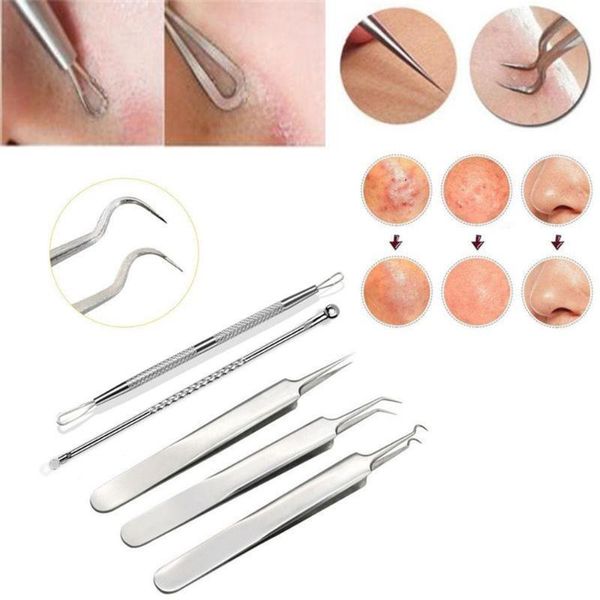 5pcs stainless facial acne spot pimple remover extractor tool comedone storage boxes & bins
5pcs stainless facial acne spot pimple remover extractor tool comedone storage boxes & bins