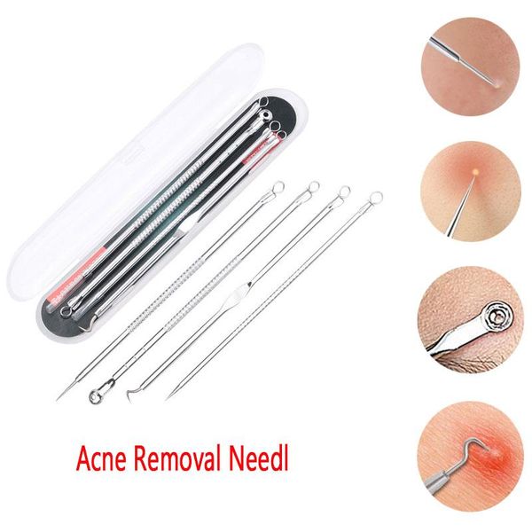 cleaning acne removal needle against black dots beauty appliances blackhead remover tool blemish face skin care facial
cleaning acne removal needle against black dots beauty appliances blackhead remover tool blemish face skin care facial