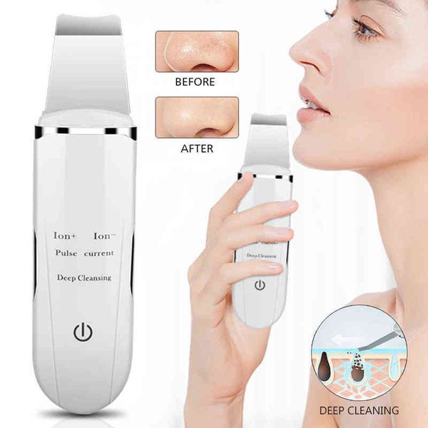 face care devices rubyonly ems ultrasonic skin scrubber blackhead remover facial spatula peeling cavitation shovel pore cleaner 220211
face care devices rubyonly ems ultrasonic skin scrubber blackhead remover facial spatula peeling cavitation shovel pore cleaner 220211