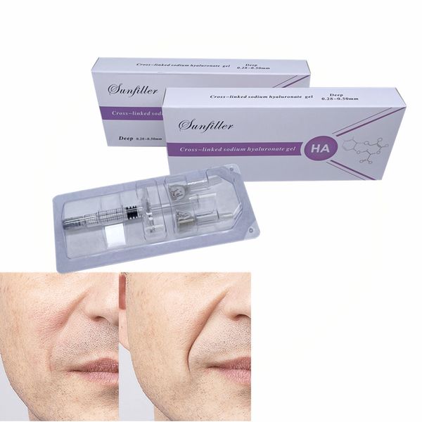 long lasting other beauty equipment safe bdde crosslinked ha face wrinkle dermal filler facial injection deep fillers
long lasting other beauty equipment safe bdde crosslinked ha face wrinkle dermal filler facial injection deep fillers