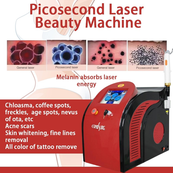 laser machine for tattoo removal q switch picolaser 1064nm 532nm 755nm pico tattoo remove on sale, Black
laser machine for tattoo removal q switch picolaser 1064nm 532nm 755nm pico tattoo remove on sale, Black