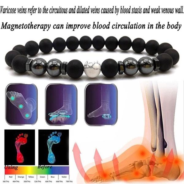 anklets colorful stone magnetic therapy bracelet weight loss magnet anklet slimming health care jewelry, Red;blue
anklets colorful stone magnetic therapy bracelet weight loss magnet anklet slimming health care jewelry, Red;blue