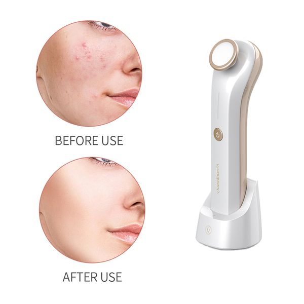 blue light plasma pen profesional facial machine for acne cleansing pimple scar acne removal beauty device ozone plasma pen perf
blue light plasma pen profesional facial machine for acne cleansing pimple scar acne removal beauty device ozone plasma pen perf