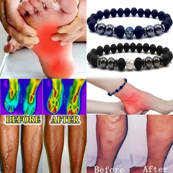 anklets 1-pc magnetic anklet beads hematite stone pain relief health care jewelry, Red;blue
anklets 1-pc magnetic anklet beads hematite stone pain relief health care jewelry, Red;blue