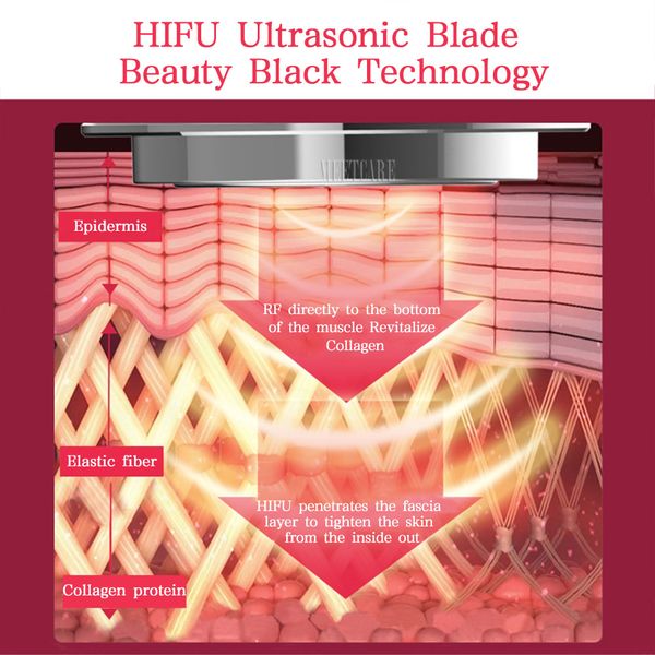 portable hifu high intensity focused ultrasound hifu face body lift hifu wrinkle removal beauty machine skin tightening care per
portable hifu high intensity focused ultrasound hifu face body lift hifu wrinkle removal beauty machine skin tightening care per