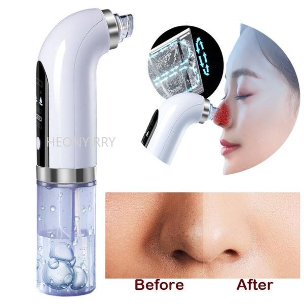 cleaning small bubble blackhead remover vacuum nose pore cleaner with usb rechargeable water hydrodermabrasion
cleaning small bubble blackhead remover vacuum nose pore cleaner with usb rechargeable water hydrodermabrasion