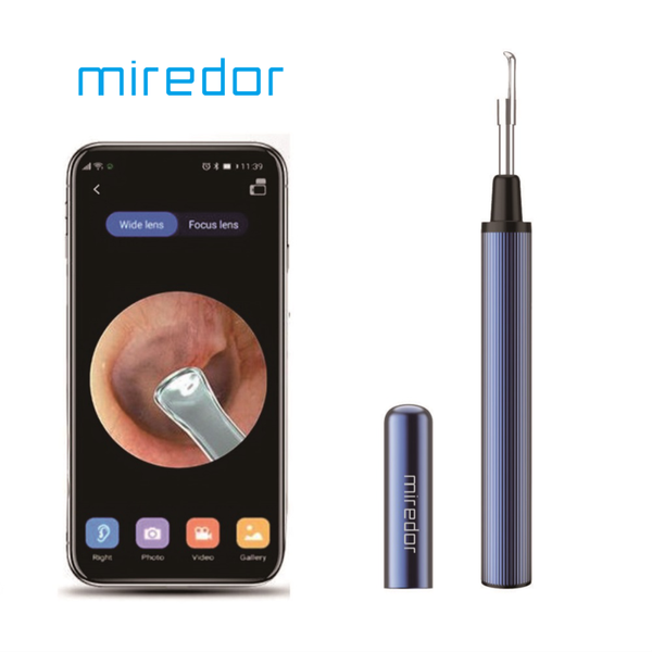 electric nose & ear trimmers otoscope cleaner,miredor earwax remover with camera 6 leds compatible & android phone for kids adult
electric nose & ear trimmers otoscope cleaner,miredor earwax remover with camera 6 leds compatible & android phone for kids adult
