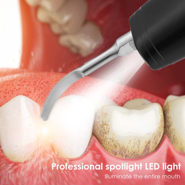 ultrasonic visual dental calculus scaler oral tooth cleaner tartar calculus remover plaque stains cleaner remova teeth whitening
ultrasonic visual dental calculus scaler oral tooth cleaner tartar calculus remover plaque stains cleaner remova teeth whitening