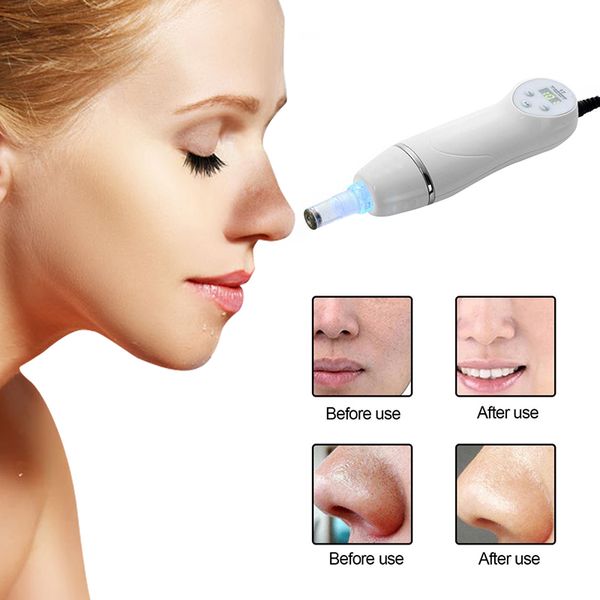 2021 microdermabrasion peeling facial pore vacuum cleanser pen diamond vacuum blackhead removal beauty machine system perfections
2021 microdermabrasion peeling facial pore vacuum cleanser pen diamond vacuum blackhead removal beauty machine system perfections