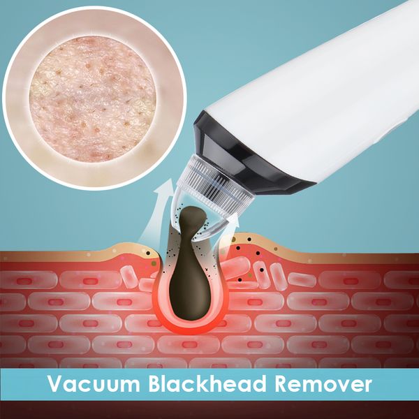blackhead instrument home electric cleansing device 300000-pixel high-definition camera wifi pore cleaning acne removeperfections
blackhead instrument home electric cleansing device 300000-pixel high-definition camera wifi pore cleaning acne removeperfections