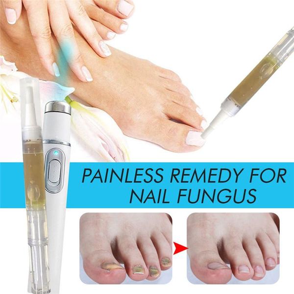 nail gel blue light repair pen toenail care solutions set for fixes and restores discolored damaged nails ey669, Red;pink
nail gel blue light repair pen toenail care solutions set for fixes and restores discolored damaged nails ey669, Red;pink