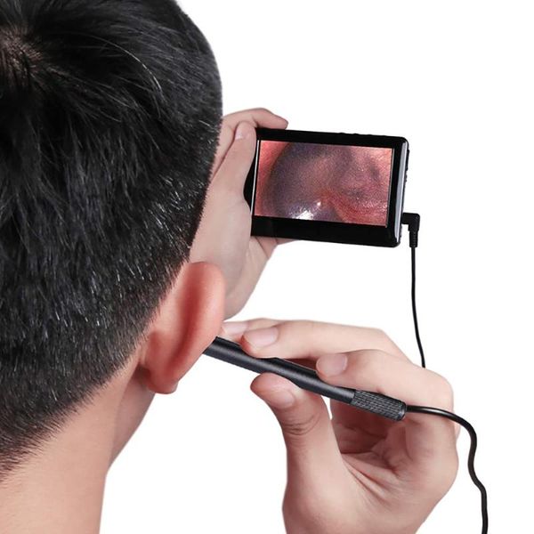 cameras 5.5mm hd ear endoscope inspect camera otoscope visual spoon cleaner earwax removal tool with 4.3 inch display screen
cameras 5.5mm hd ear endoscope inspect camera otoscope visual spoon cleaner earwax removal tool with 4.3 inch display screen