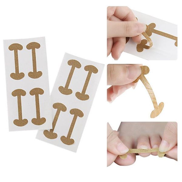 nail art kits ingrown corrector sticker fingernail treatment care repairing pedicure tools manicures tool
nail art kits ingrown corrector sticker fingernail treatment care repairing pedicure tools manicures tool