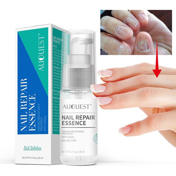 nail repair essence
