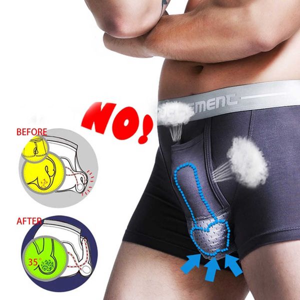 underpants men breathe underwear bullet separation scrotum physiological mens breathable boxers panties ropa interior hombre new, Black;white
underpants men breathe underwear bullet separation scrotum physiological mens breathable boxers panties ropa interior hombre new, Black;white