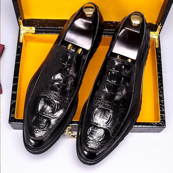 dress shoes phenkang men genuine leather crocodile formal classic style burgundy mens wedding slip on pointed toe oxford, Black
dress shoes phenkang men genuine leather crocodile formal classic style burgundy mens wedding slip on pointed toe oxford, Black