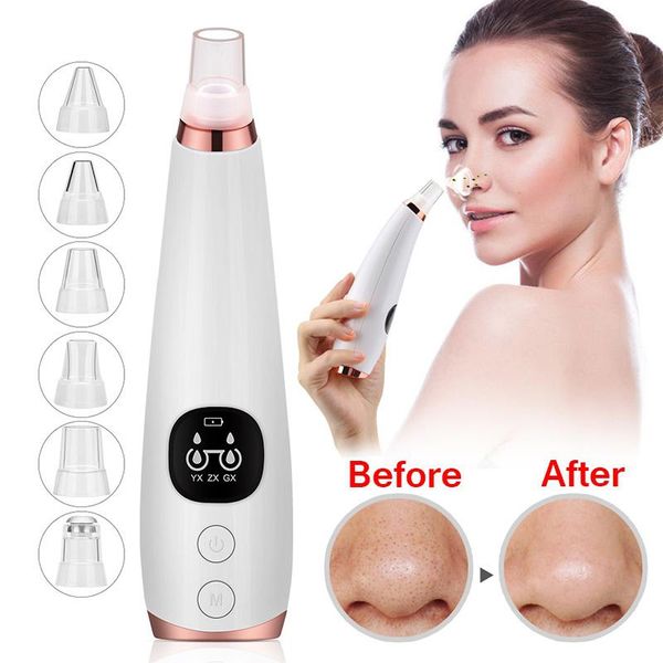 blackhead remover vacuum face deep pore vacuum acne cleaner for remove pimple skin tag nose cleansing instrument skin care toolsscouts
blackhead remover vacuum face deep pore vacuum acne cleaner for remove pimple skin tag nose cleansing instrument skin care toolsscouts